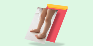 Explore the intriguing world of pes planus in children, commonly known as flat feet. Discover its causes, how clinicians diagnose the condition, and the available treatment options. Gain valuable insights to support your child's foot health journey.